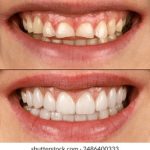 756开奖前后出现的神秘规律大揭秘 2xnnw1do2f